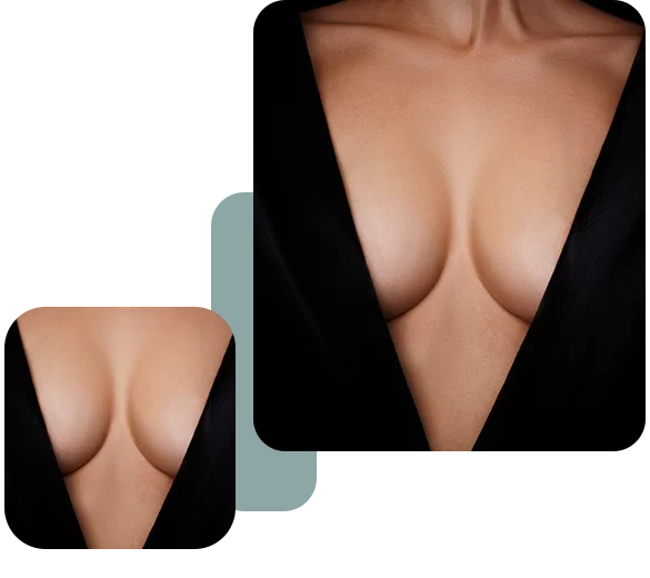 Breast Reconstruction​