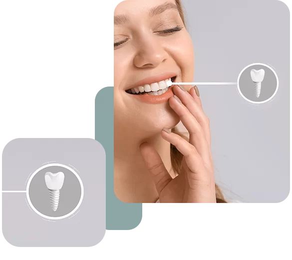 Dental Implant Treatment