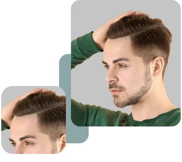 FUE Hair Transplant