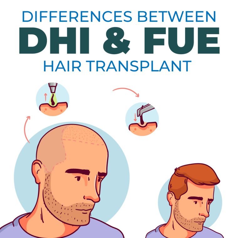 Differences between DHI and Sapphire FUE Methods - Este in Turkey