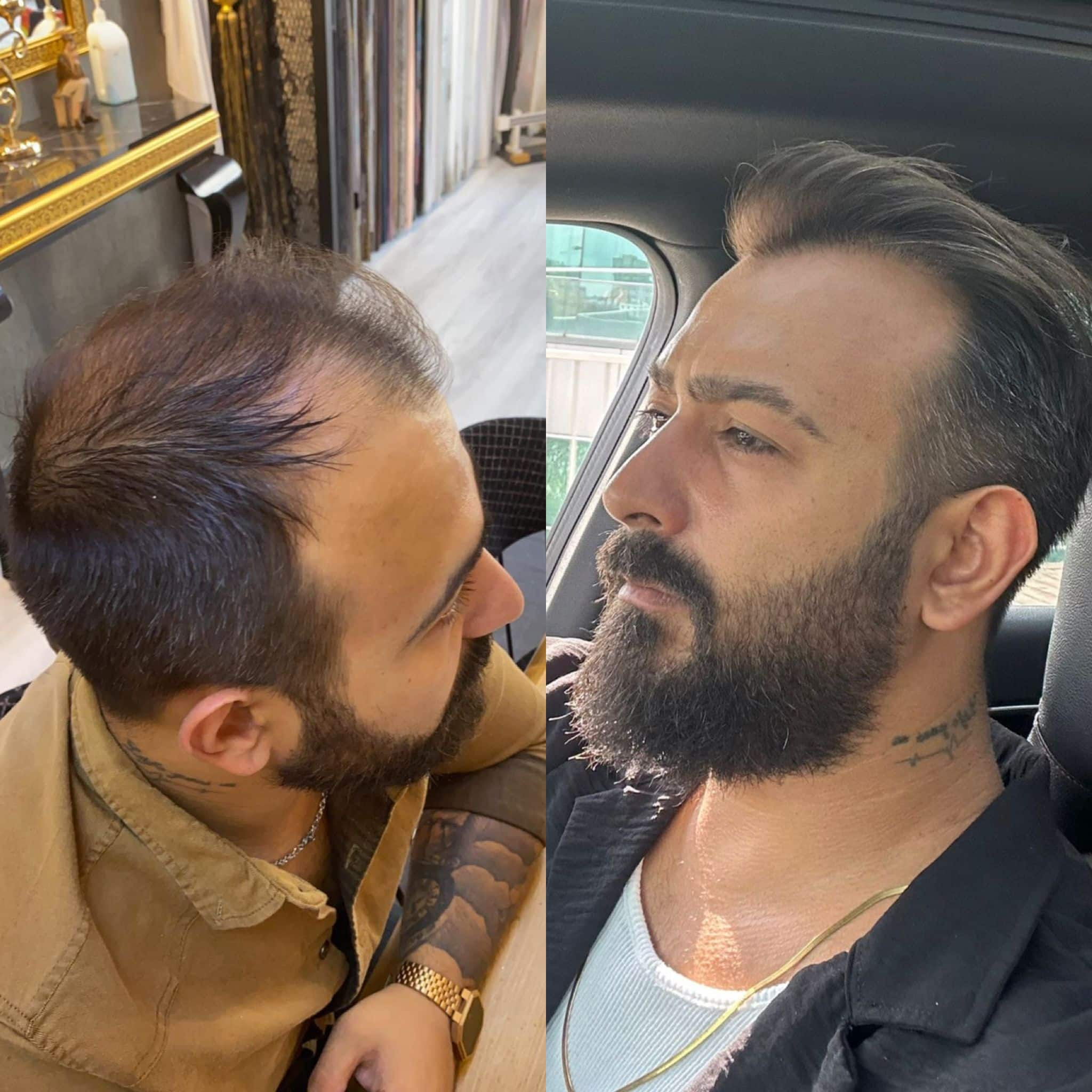 Before and after 9