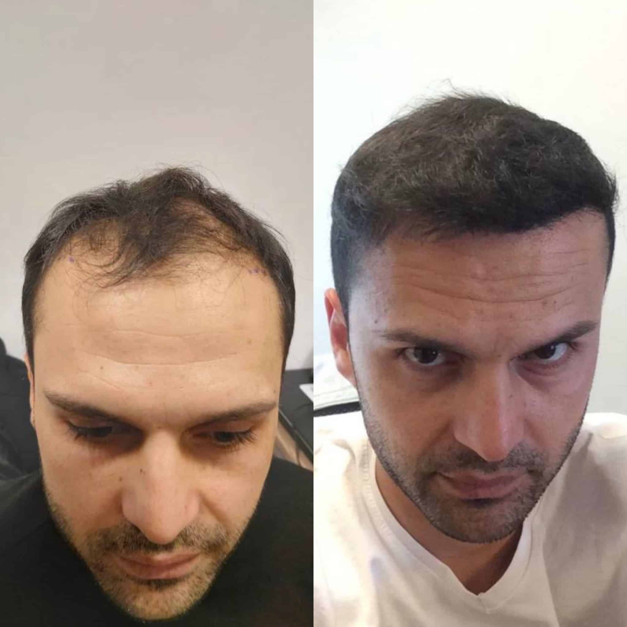 Before and after 8