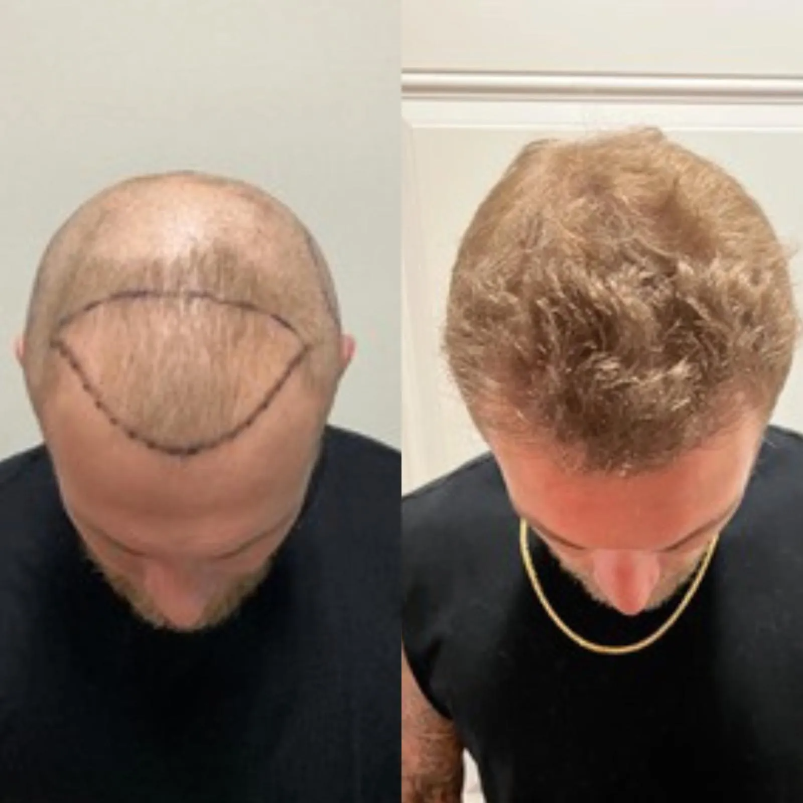 Before and after 7