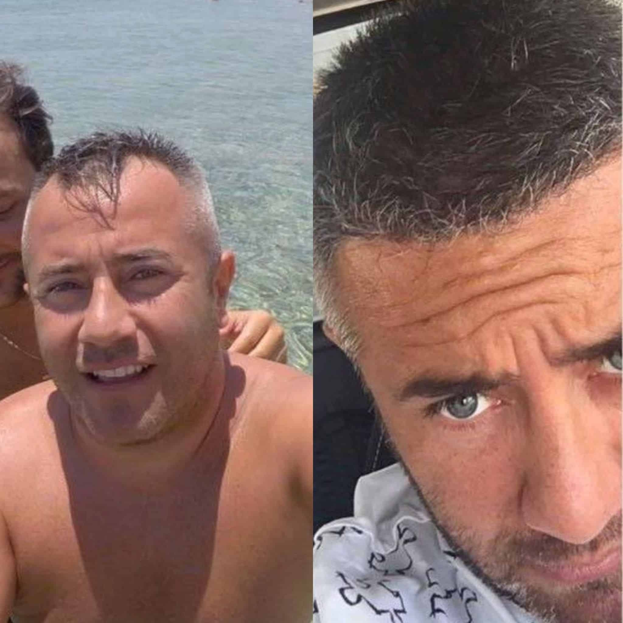 Before and after 6
