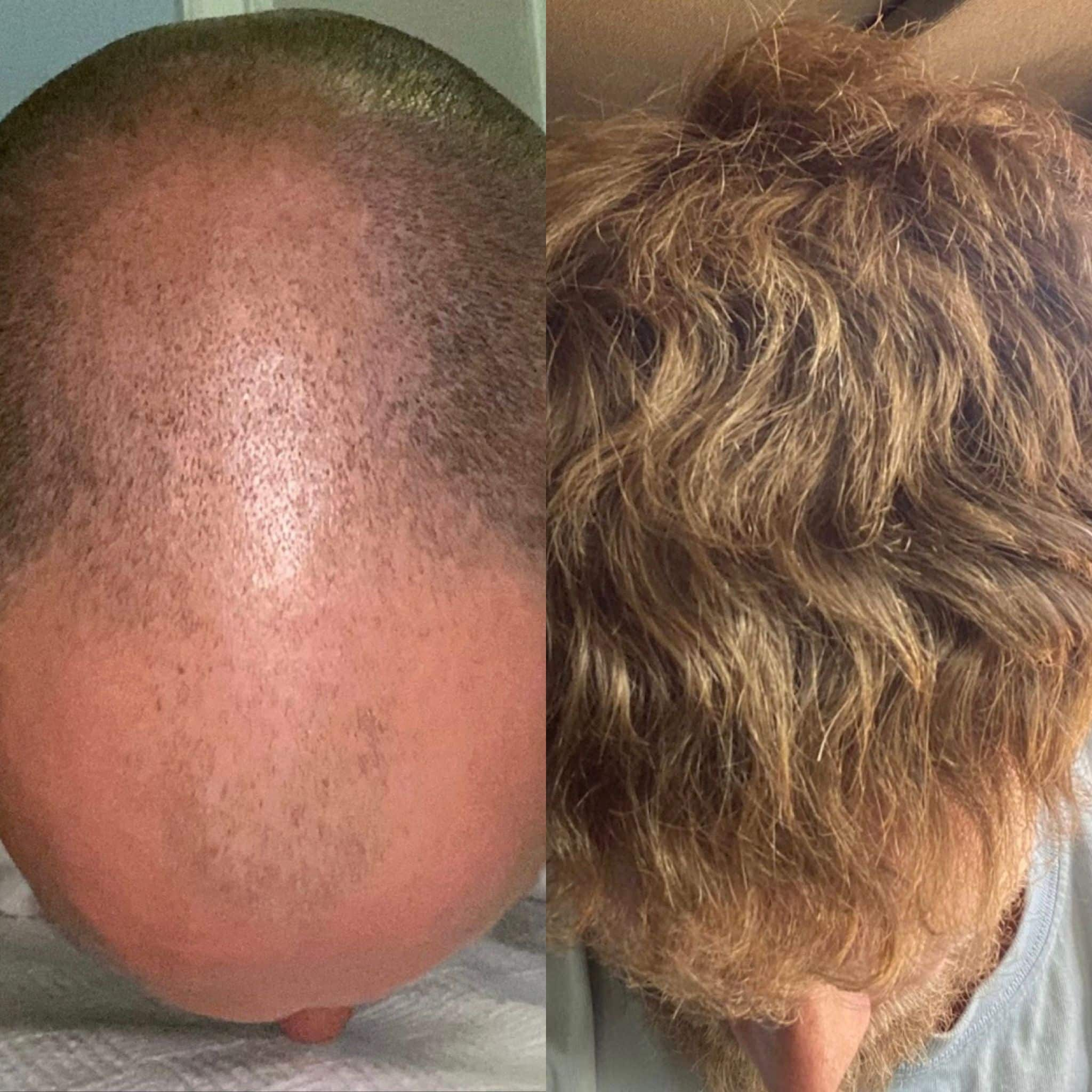 Before and after 5