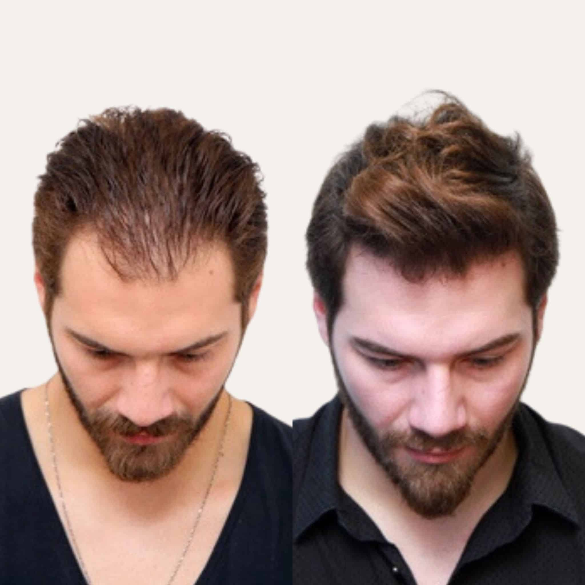 Before and after 4