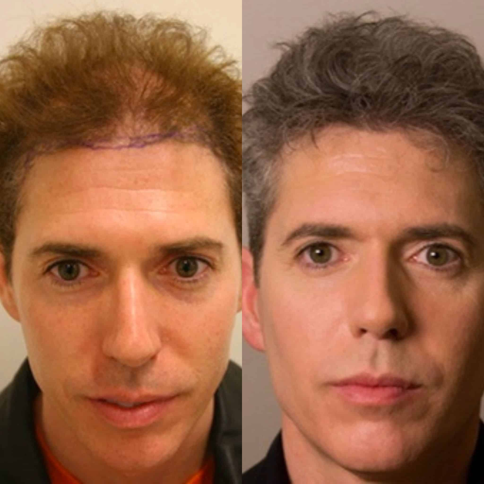 Before and after 3