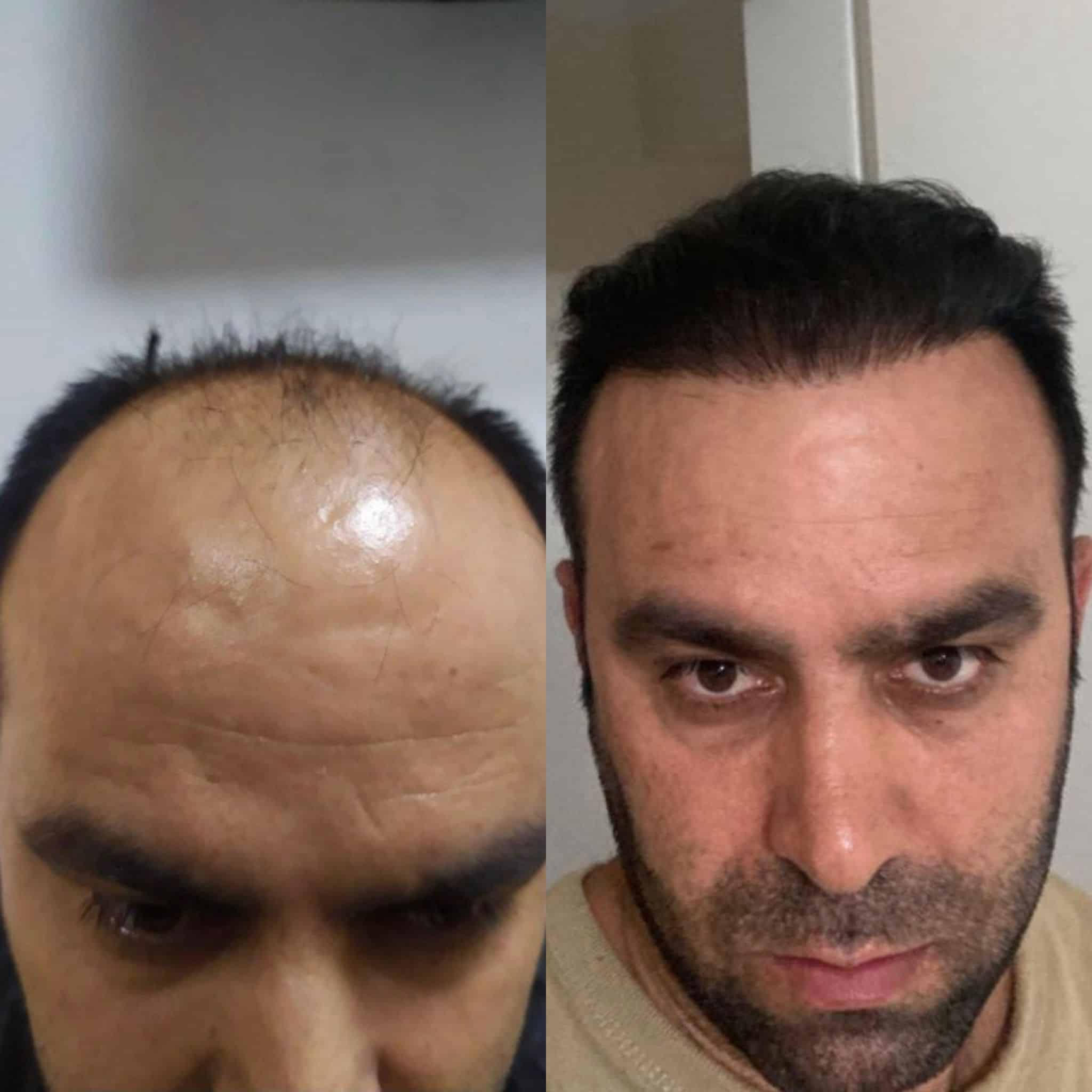 Before and after 2