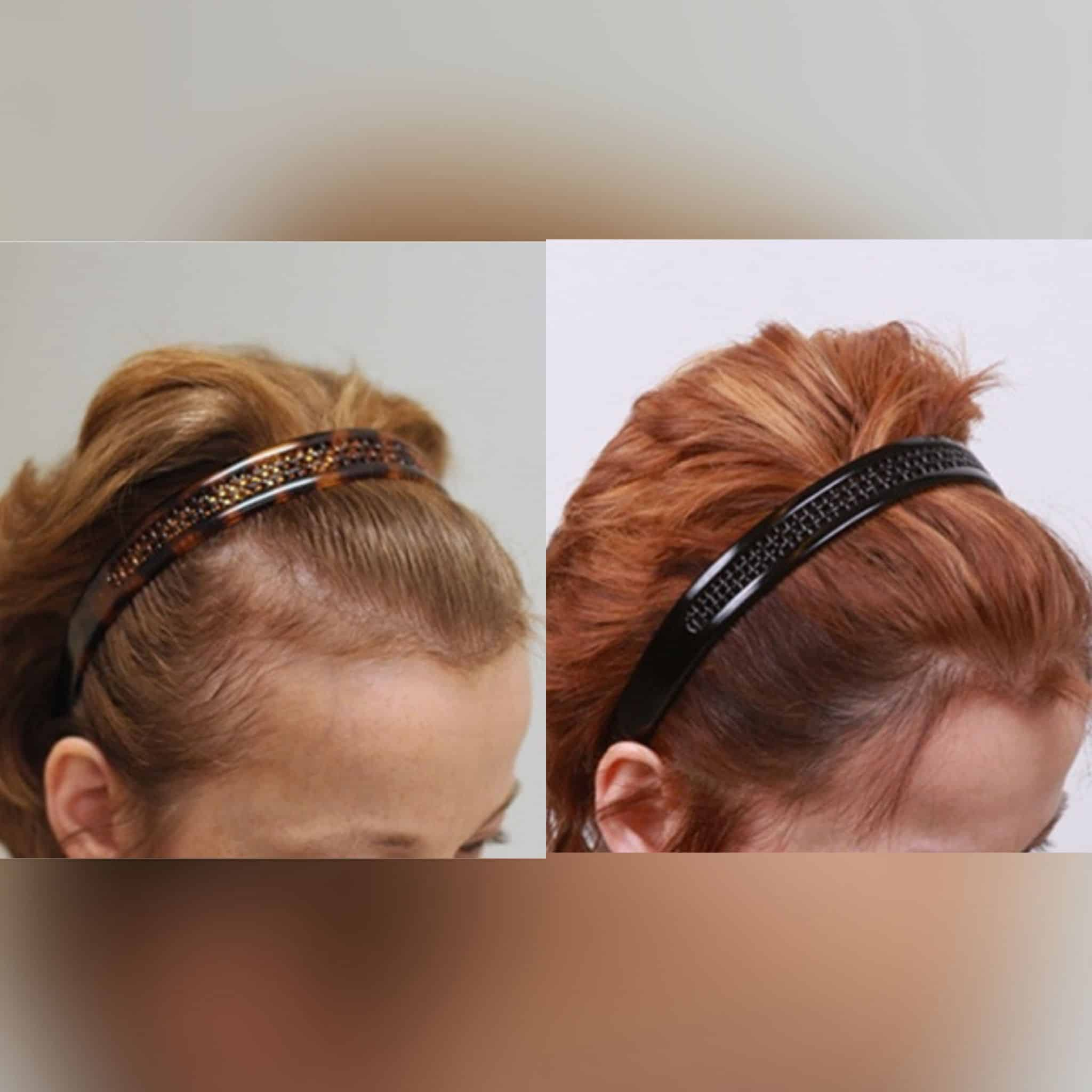 Before and after 10