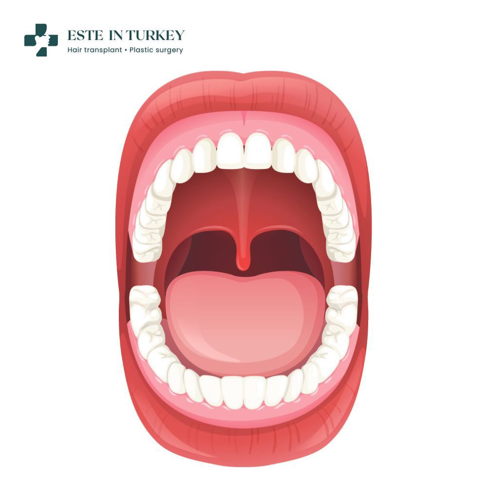 Dental treatment — healthy teeth