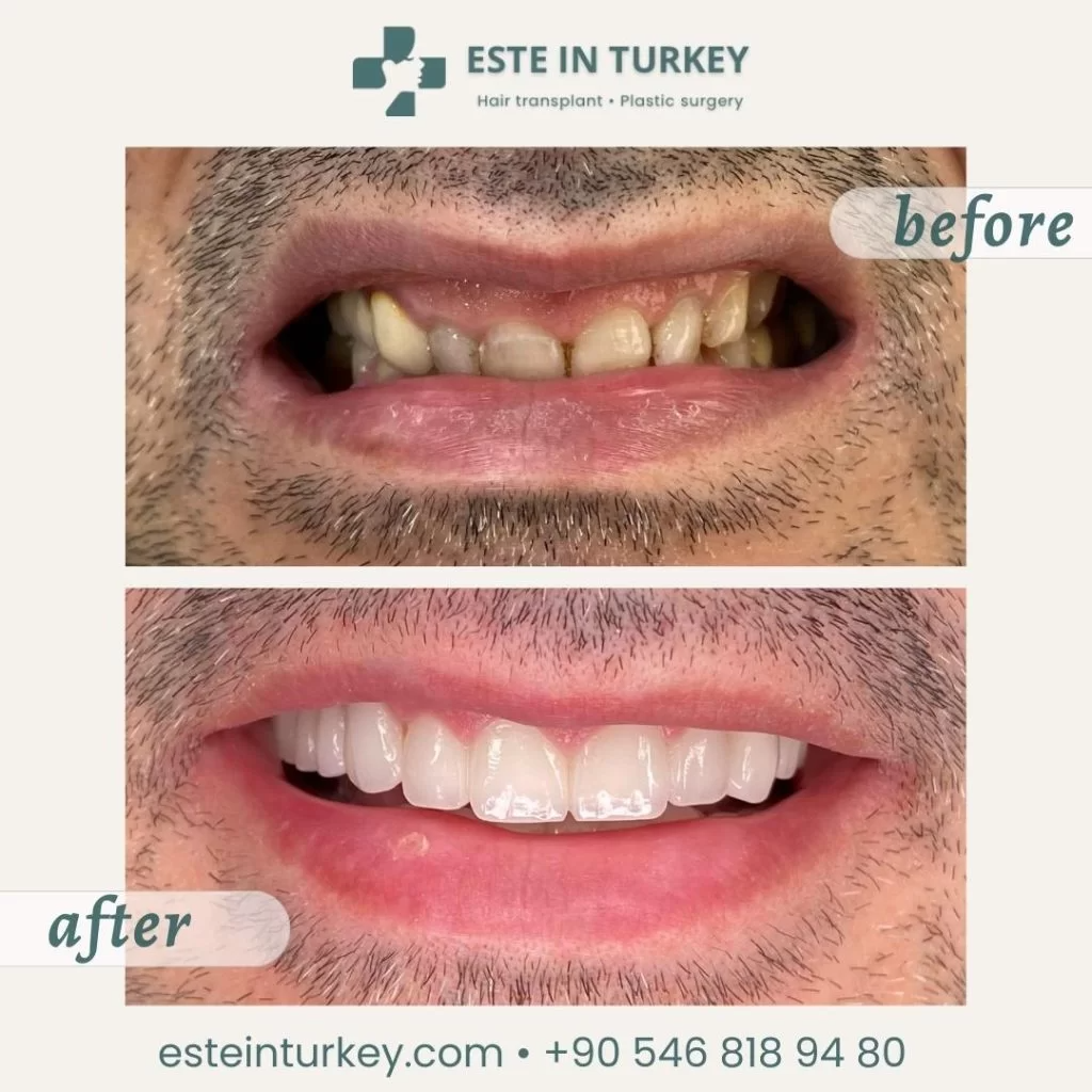 Before & after — dentistry 9