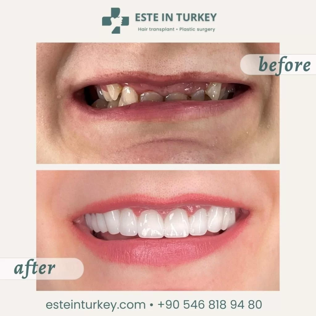 Before & after — dentistry 8