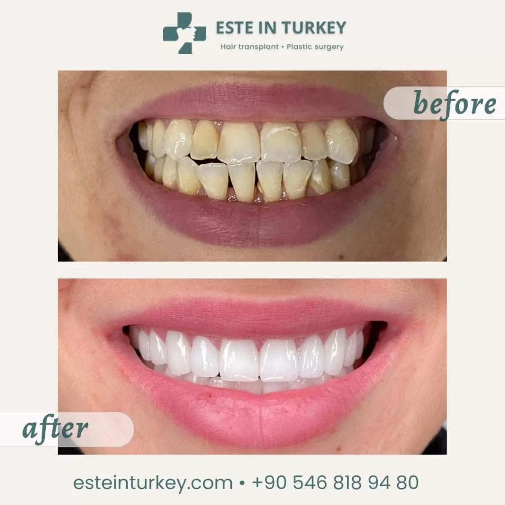 Before & after — dentistry 7
