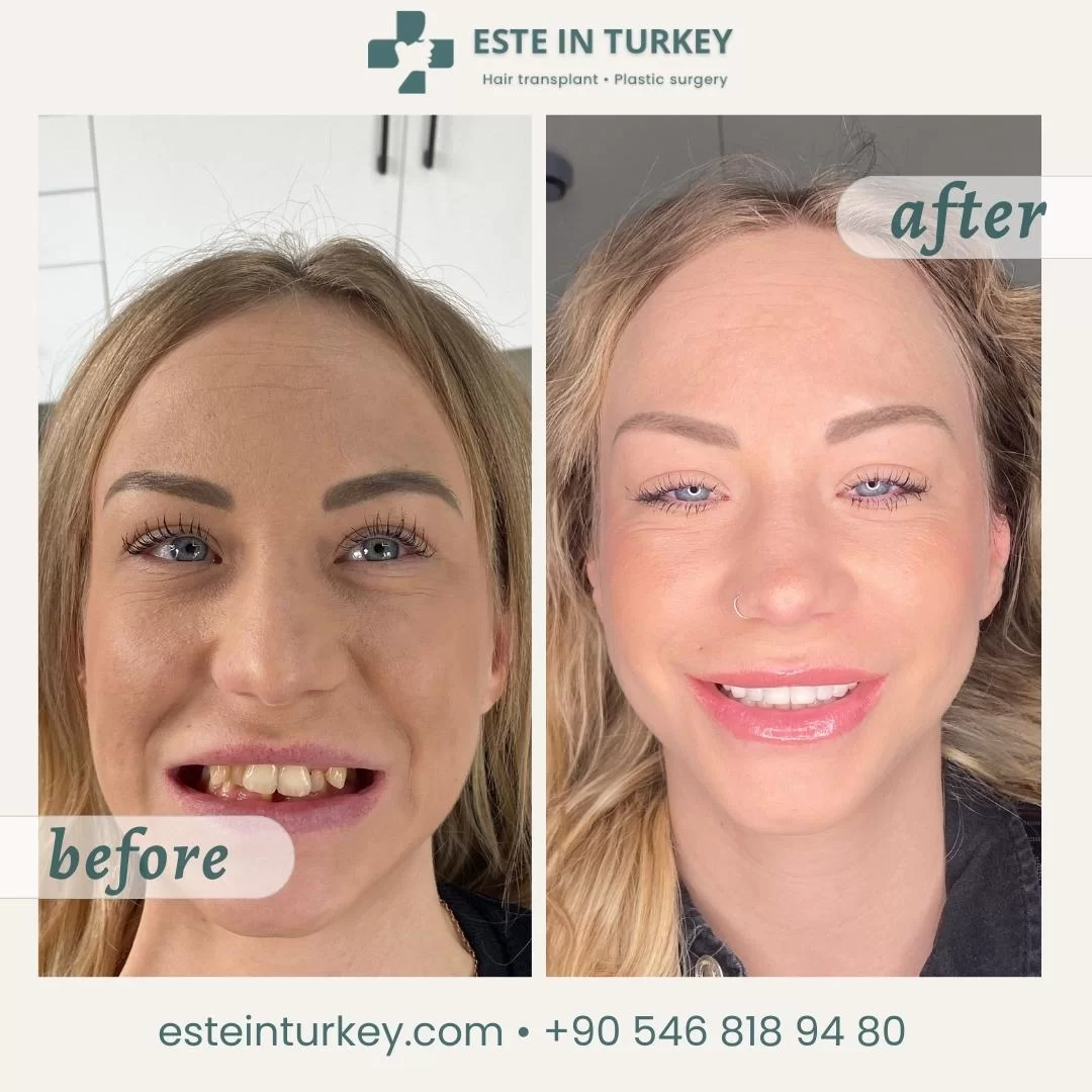 Before & after — dentistry 5