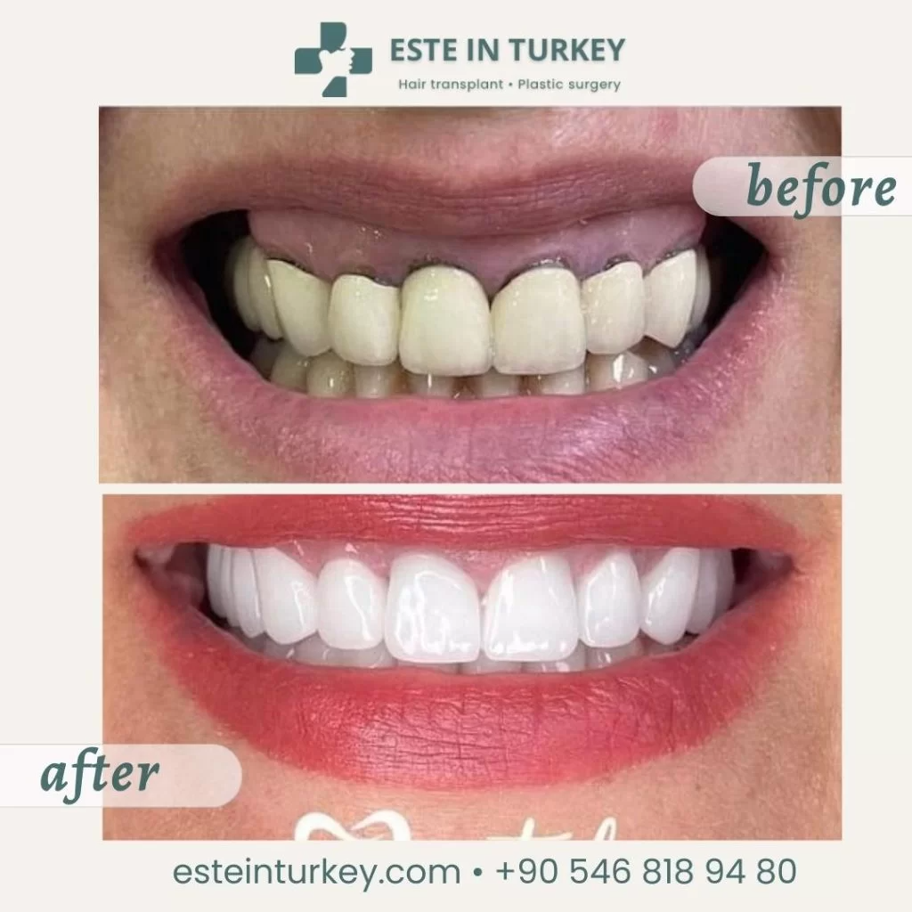 Before & after — dentistry 6