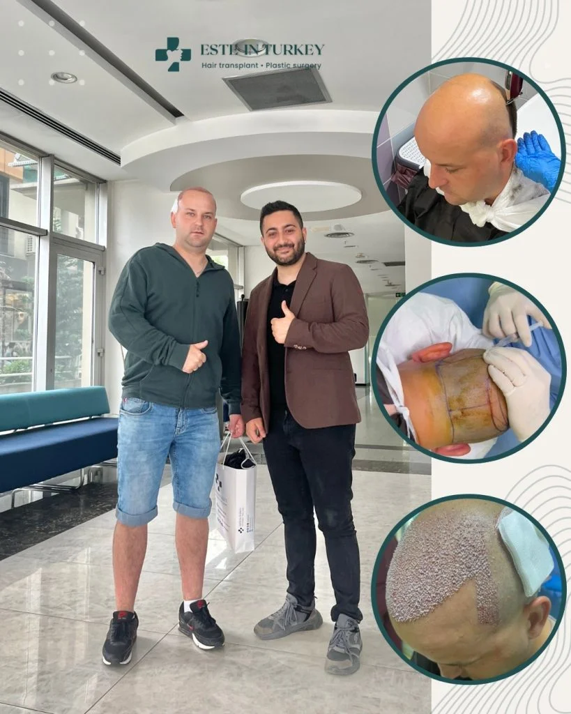 Счастливый пациент клиники ESTE IN TURKEY