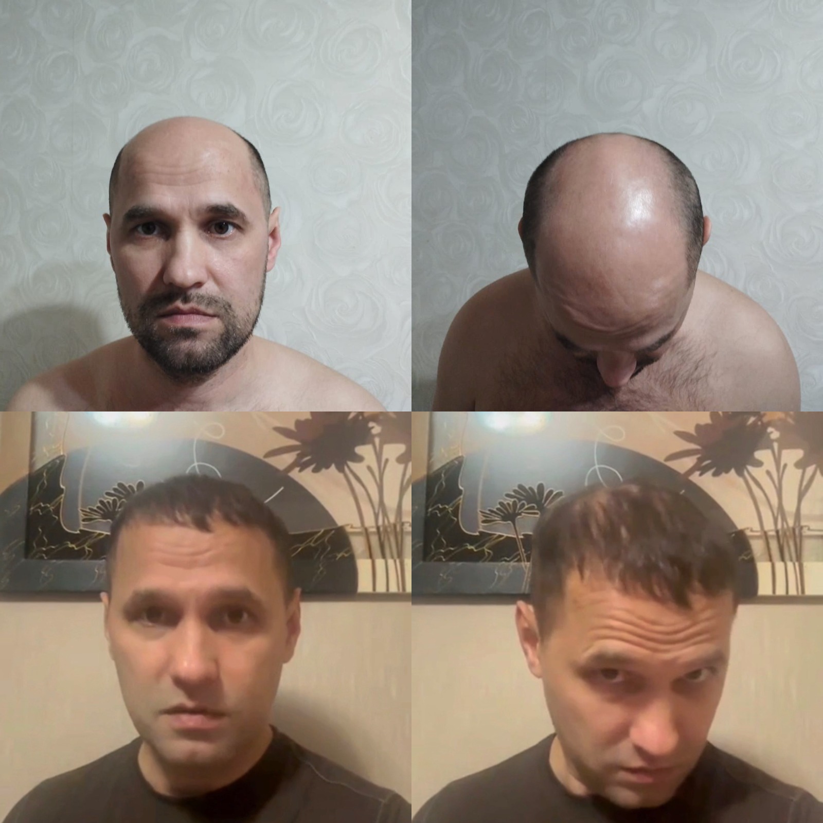 Povestea pacientului — rezultat