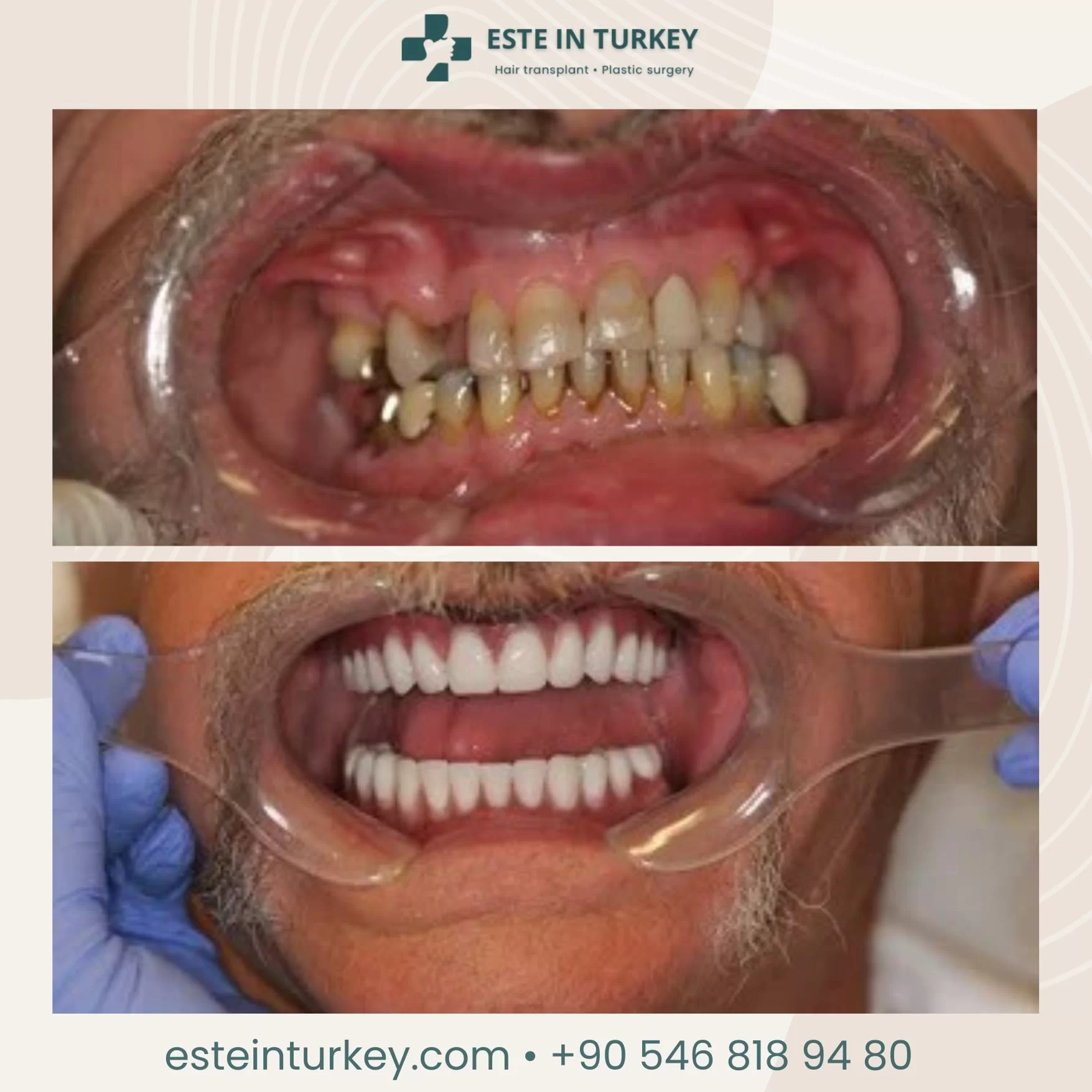 Before & after — dentistry 4