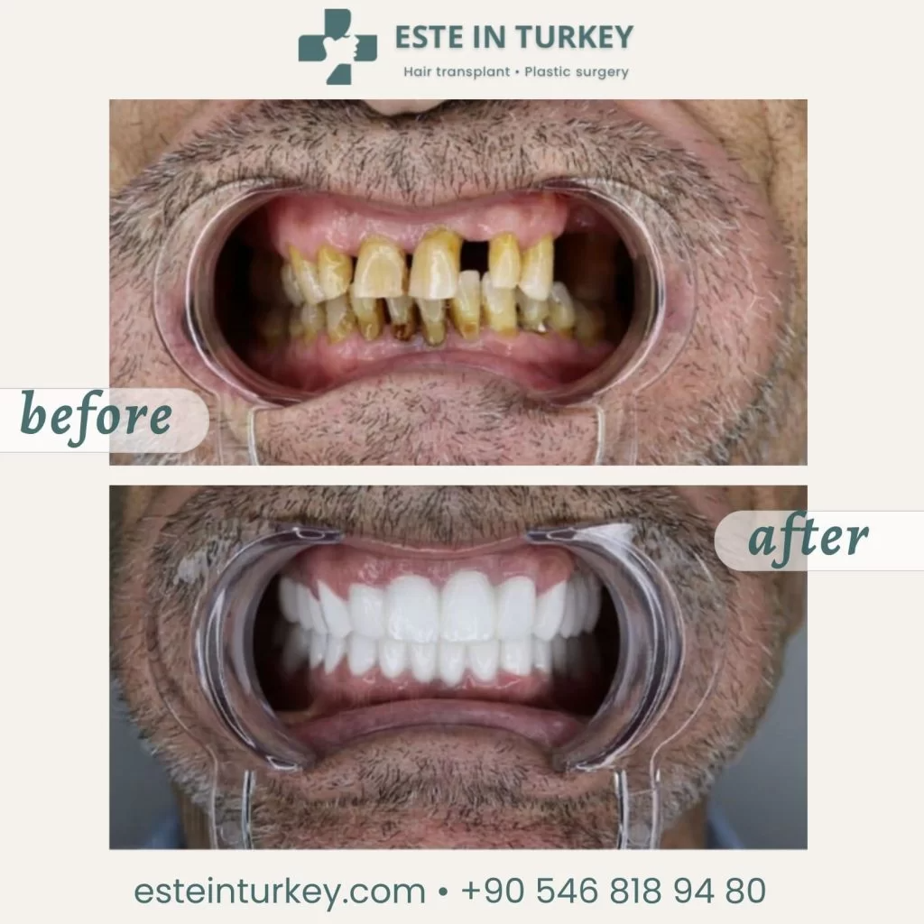 Before & after — dentistry 3