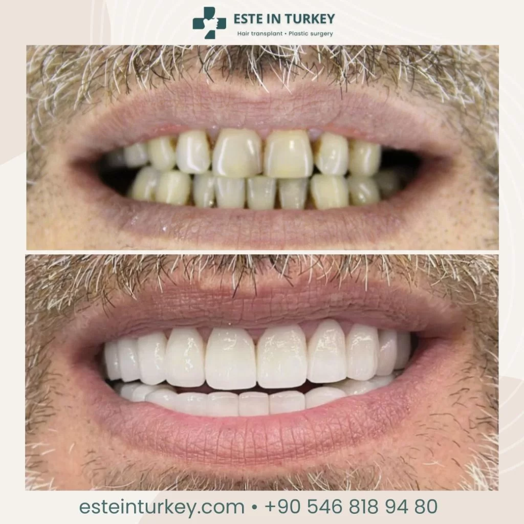 Before & after — dentistry 2